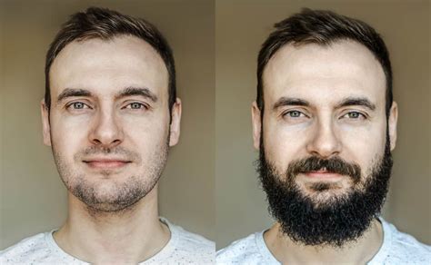 6 Reasons Why Can T I Grow A Beard Plus Growth Tips Bald Beards