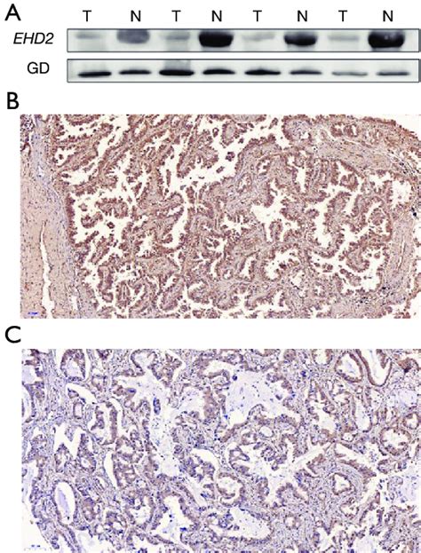 Expression Of Ehd2 In Luad Tissues A Western Blot Analysis Of Ehd2