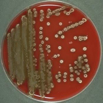 BACILLUS SUBTILIS