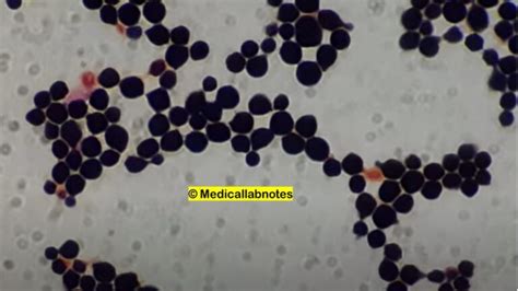 Cryptococcus Introduction Morphology Pathogenicity Lab Diag