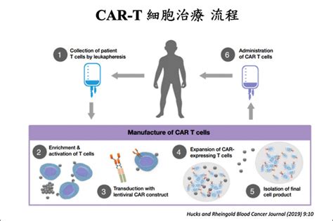 Car T細胞治療 10歲女童癌細胞清零 生活 自由時報電子報