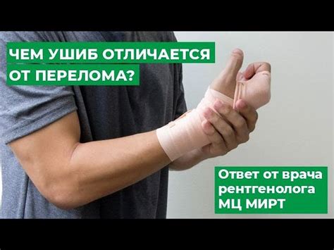 Как определить перелом руки: признаки и симптомы