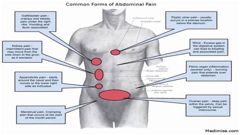 abdominal pain right side