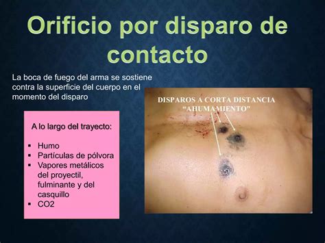 Heridas Por Arma De Fuego Ppt