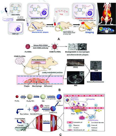 Applications of mesoporous silica in the diagnosis and treatment of AS ...