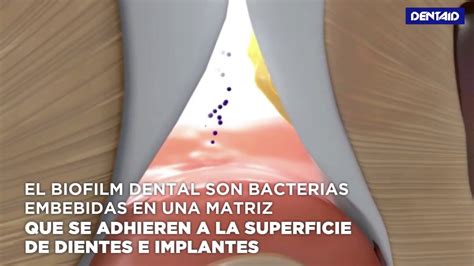 ¿qué Es El Biofilm Dental Youtube