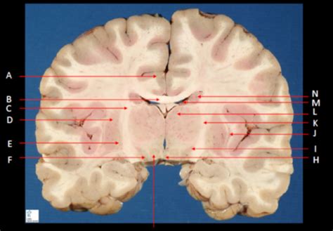 Diagram Of Coronal Section Quizlet