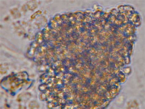 Oct 4 Positive ES Like Cells Transcription Factor Oct 4 Is A Marker Of