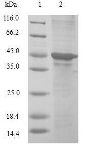 Recombinant Human Cold inducible RNA binding protein CIRBP 重组蛋白 武汉华美生物