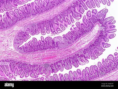 Small Intestine Light Micrograph Stock Photo Alamy