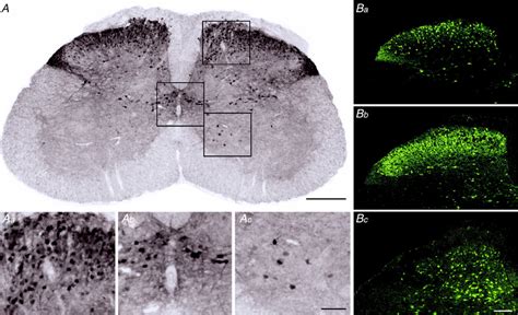 Gfp Tagged Neurons In The Spinal Dorsal Horn Of Vglut Gad And