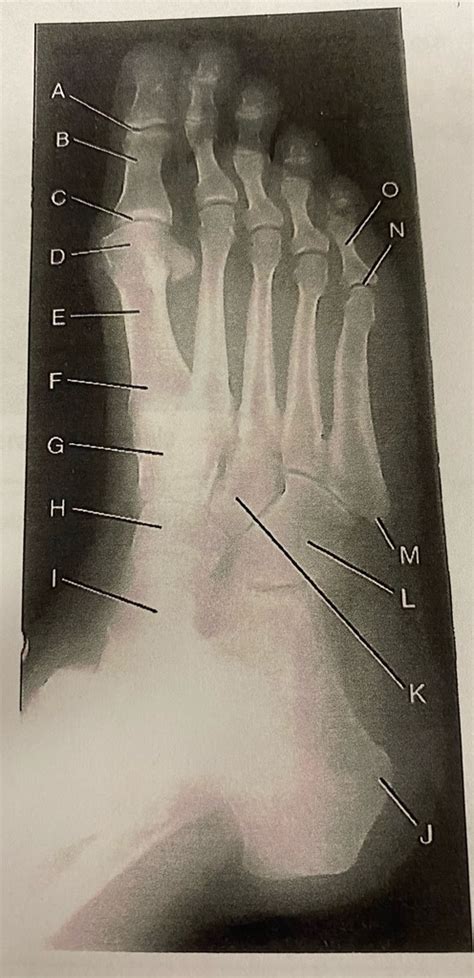 Xray Foot Diagram Quizlet