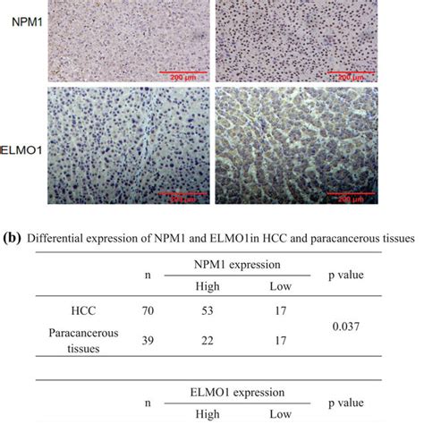 Npm And Elmo Expression Was Significantly Upregulated In Human