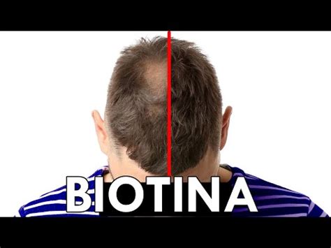 Biotina y Zinc para el pelo Descubre cómo fortalecer y hacer crecer tu