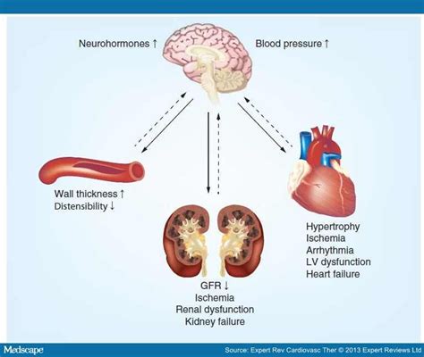 Renal Denervation In Treatment Resistant Hypertension