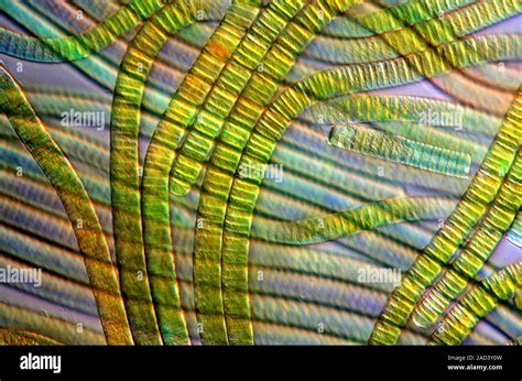 Oscillatoria Cyanobacteria Darkfield Illuminated Polarised Light