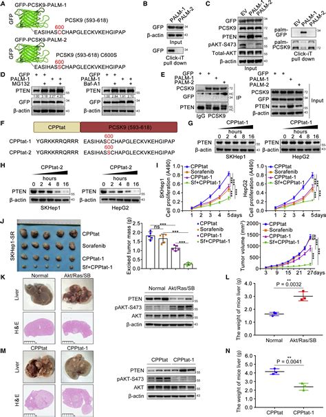 S Palmitoylation Of Pcsk9 Induces Sorafenib Resistance In Liver Cancer