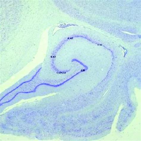 Structure And Topography Of The Hippocampus And Gyrus Dentatus In The