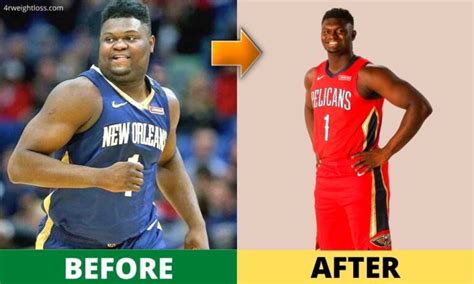 Zion Williamson Weight Loss 2024 Diet Injury Surgery Before And After