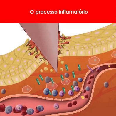 Processo Inflamat Rio Imunologia B Sica