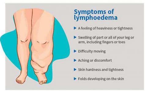 Lymphoedema Mld Hertfordshire Manual Lymphatic Drainage In