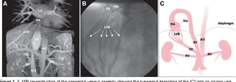 Figure From Reports In Arrhythmia And Electrophysiology Successful