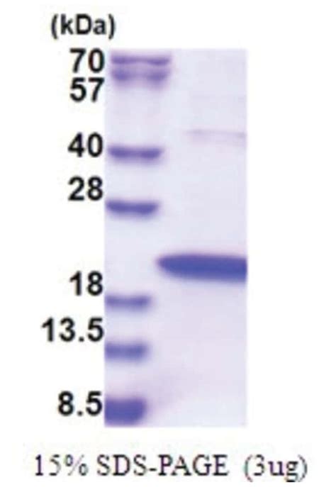 Novus Biologicals Recombinant Human ZNHIT1 His Protein:Recombinant ... 