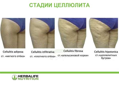 Целл-у-лосс - новинка от Herbalife. Деликатное выведение лишней ...