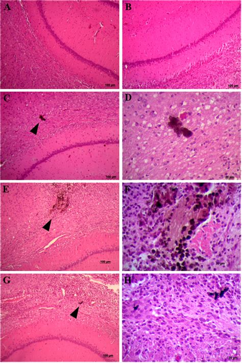 Histological analysis of hippocampus of rats infused with saline ... 