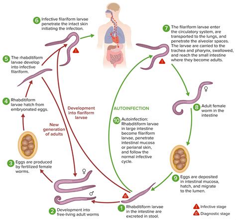 Strongyloidiasis Concise Medical Knowledge