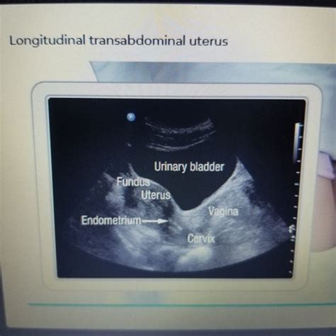 Obgyn Flashcards Quizlet