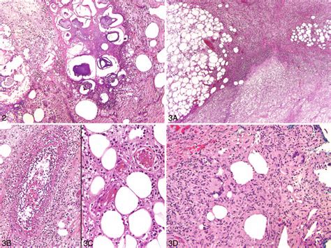 Saponification Histology