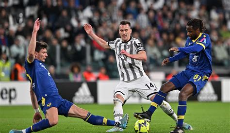 Gallery | Juventus vs Hellas Verona - Juventus