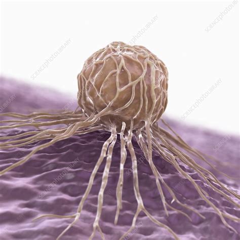 Breast Cancer Cell Artwork Stock Image C020 4858 Science Photo