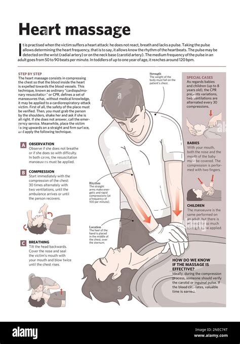 Infograf A Sobre La Reanimaci N Cardiopulmonar Una Reanimaci N