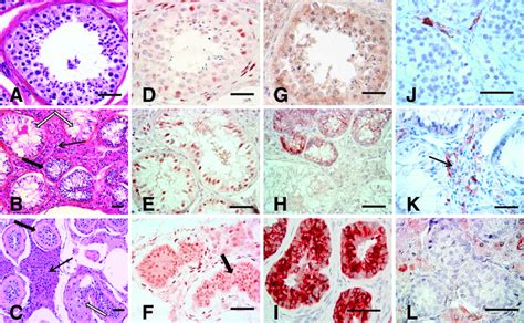 Histological characteristics and immunohistochemical detection for AR ... 