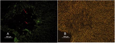 Assessment Of Neuroprotective Properties Of Melissa Officinalis In