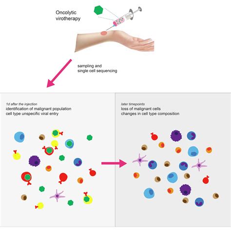 Oncolytic Virotherapy Mediated Anti Tumor Response A Single Cell