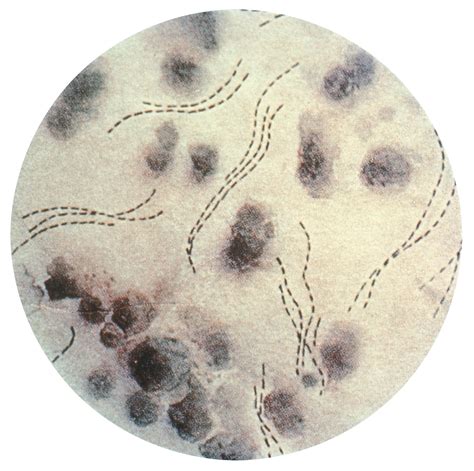 Haemophilus Gram Stain