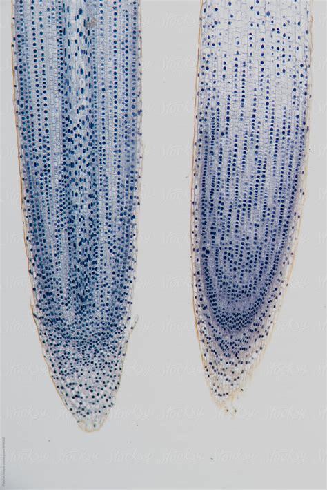 Typical Plant Cell Of Root Tip Micrograph By Stocksy Contributor