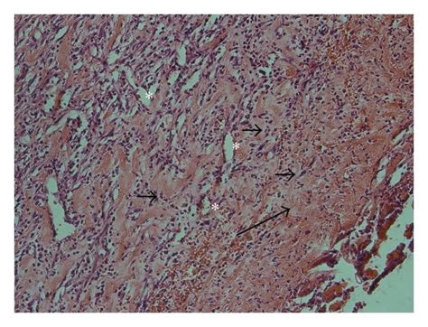 Histopathology Of Burn Wounds At Day 14 Stained With Hande 200x A