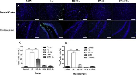 Apoptosis in cerebral cortex and hippocampus (magnification: A, B ... 