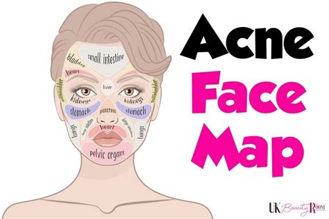 Acne Face Map What Your Acne Is Telling You About Your Health