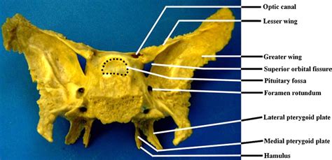 Lateral Pterygoid Plate Of Sphenoid Bone