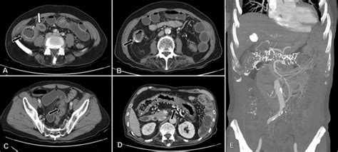 Contrast Enhanced Abdominal Computed Tomography Ct Imaging Axial Download Scientific