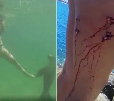 Turista Atacada E Mordida Por Le O Marinho Durante Mergulho Fotos