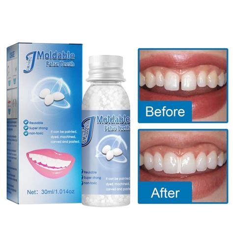 30ml Temporary Tooth Repair Kit Teeth And Gaps Moldable Falseteeth