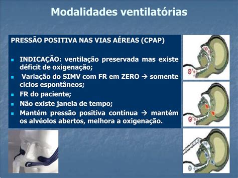 Ppt VentilaÇÃo MecÂnica Princípios Básicos Powerpoint Presentation