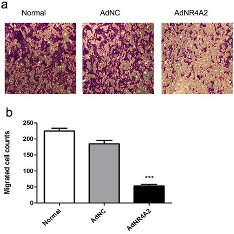 Adnr A Treatment Inhibits The Migration And Invasion Ability In