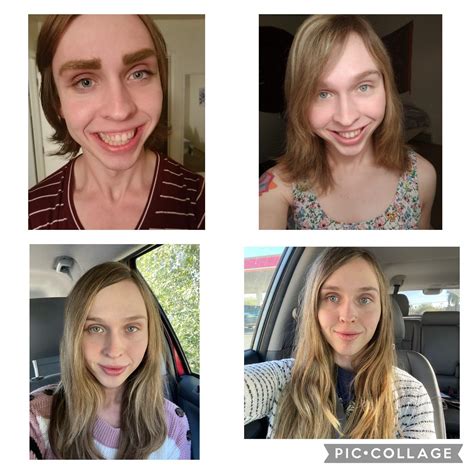 3 years on hormones 😍 : r/transtimelines